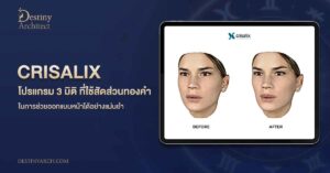 Crisalix: เทคโนโลยี 3D สำหรับการจำลองและออกแบบใบหน้าก่อนการศัลยกรรม